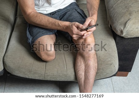 Young man with leg amputation sitting on sofa with mobile phone in hand Imagine de stoc © 
