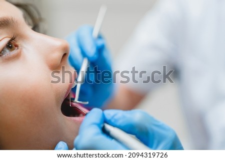 Close up cropped photo of curing healing operating teeth tooth, filling mouth cavity against caries decay dentist orthodontist in dental clinic. Stomatology concept Stock foto © 