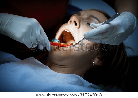 Dentist examining a patients teeth before oral surgery at the dental clinic. Removing amalgam fillings. Professional care of patient teeth.