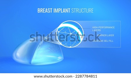 Breast implant in section with material infographic. Realistic prosthesis for breast enlargement - mammoplasty. Vector illustration on a bright blue background