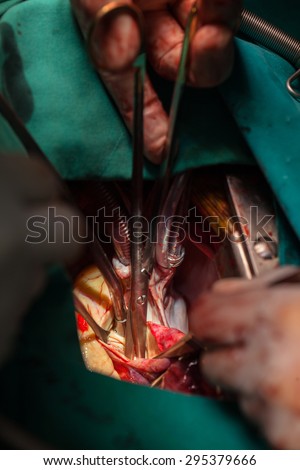 Heart  surgery  in operating room