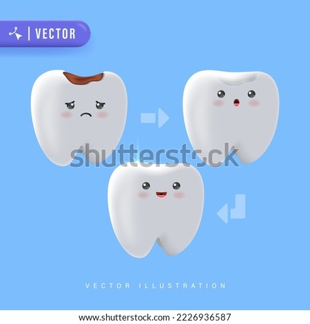 Step of Tooth Filling Illustration Vector on Blue Background. Dental Care Concept. Treatment Of Caries.