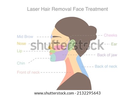 Highlight on woman's face area to do laser hair removal treatments. Illustration about diagram for a beauty treatment with laser.