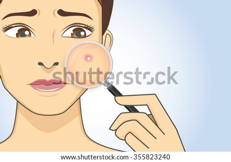 A magnifier on hand magnifying the woman facial to finding acne on her face area. She is feeling stress because of acne.