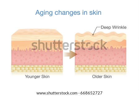 Aging Changes in Skin. Illustration about medical diagram and health care.