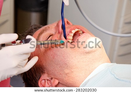 local anesthesia with a syringe between the teeth against the pain
