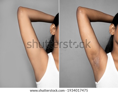 Asian Armpits