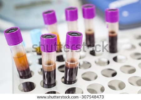 Blood Collection Tube diagnostic Test
