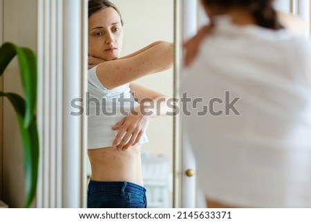 Woman looks in to a mirror an itching rash on dry flaky skin, as in the psoriasis, eczema and other diseases Foto d'archivio © 