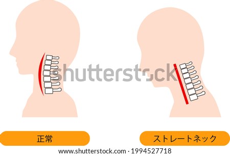 This is an illustration of a straight neck and a normal neck bone. Japanese is normal and straight neck (text neck).
