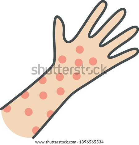 Similar – Image, Stock Photo Measles or rubeola rash on Caucasian man’s skin