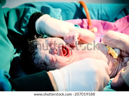 Baby being born or baby  minutes after the birth.