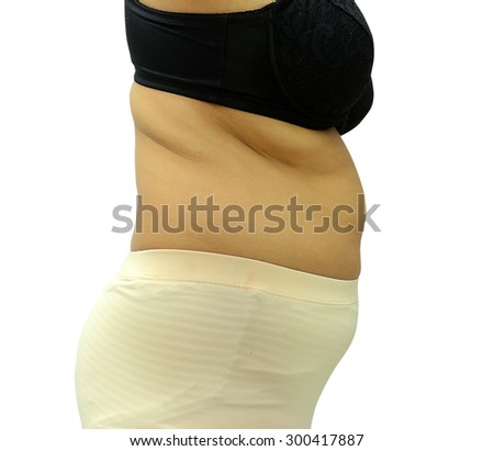 Women with fat belly and stretch marks.