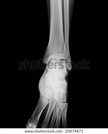 X-Ray Skeleton