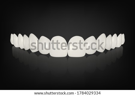 Vector 3d Realistic Render White Denture Set Closeup Isolated. Dentistry and Orthodontics Design. Human Teeth for Medical and Toothpaste Concept. Healthy Oral Hygiene, Jaw Prosthesis, Veneers