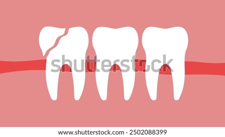 broken tooth, flat color illustration