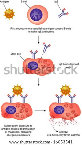 Illustration Of Anaphylaxis - 16053541 : Shutterstock