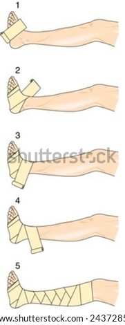 Application Of Figure Of Eight Bandage Stock Vector Illustration ...