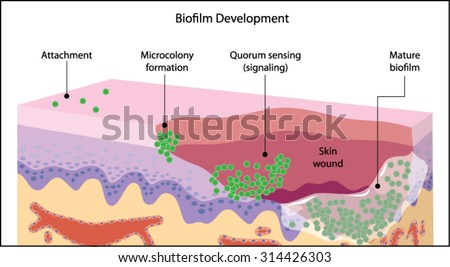 Growth of a bacterial biofilm on a skin wound, from initial attachment through microcolony formation, signalling and mature biofilm