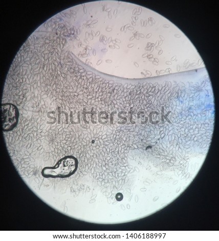 Népszerű név pinworms. Pinworms betegség neve, Dr. Diag - Oxyuriasis