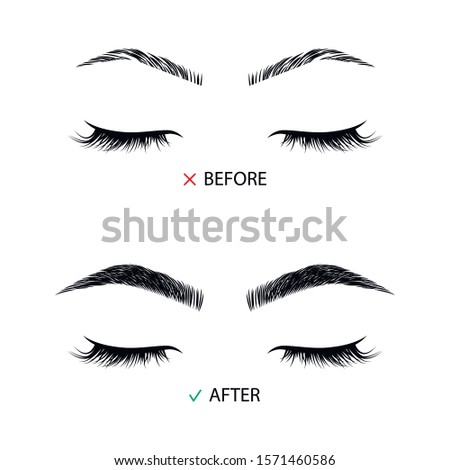 Brow correction before and after illustration