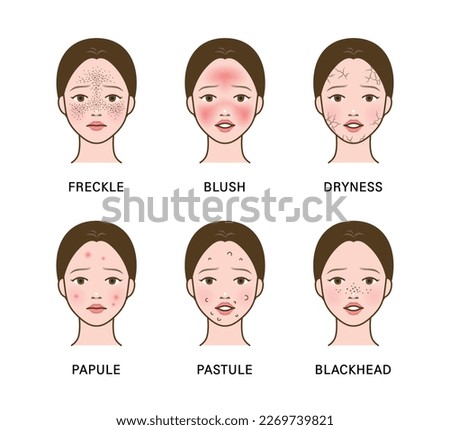Cosmetic skin trouble_woman with freckle, blush, dryness, papule, pastule, blackhead