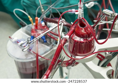 Blood filter on extracorporeal machine during the open heart surgery