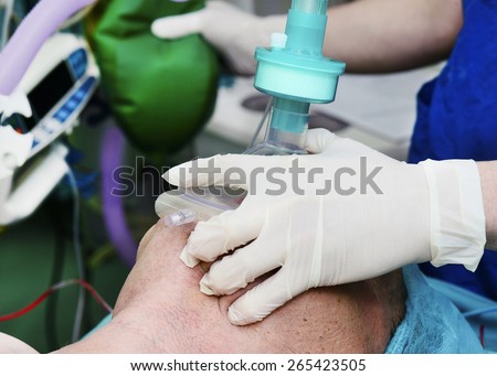 Artificial ventilation of a patient by a mask during anesthesia