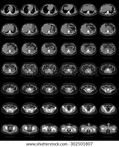 computer tomography of chest and abdomen, ct scan isolated on black background.