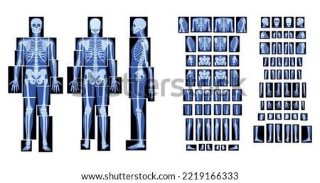 Set of X-Ray Skeleton Human body - hands, legs, chests, heads, vertebra, pelvis, Bones adult people roentgen front back side view. 3D realistic flat blue color Vector illustration of medical anatomy