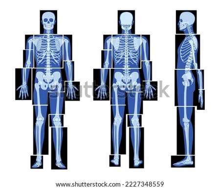 Set of X-Ray Skeleton Human body parts - hands, legs, chest, head, vertebra, pelvis, Bones adult people roentgen front back side view. 3D realistic flat concept Vector illustration of medical anatomy