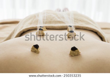 Back of the woman that moxibustion was arranged