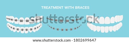 Teeth with or without braces. Arch braces without teeth. Orthodontic dentistry. The alignment of the teeth. Healthy lifestyle and dental care. Beautiful white teeth. Isolated flat vector illustration