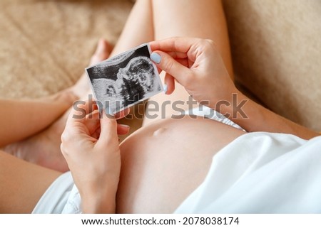 Ultrasound baby Photo. Unborn child in ultrasound picture In female hands of pregnant woman. Ivf image Near pregnant belly on couch at home. Mom expecting baby. Motherhood Close up. High quality photo Stockfoto © 
