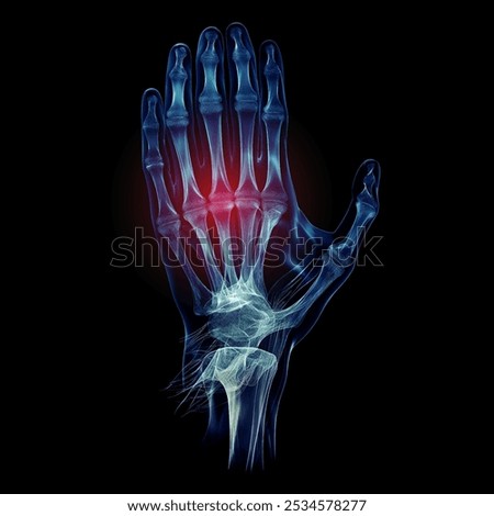 Humen hand bone with injury x-ray film on a dark blue background