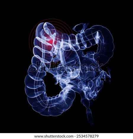 Humen colon with injury x-ray film on a dark blue background