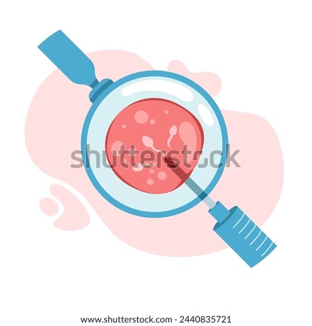 intra cytoplasmic Insemination of Sperm artificial insemination Concept