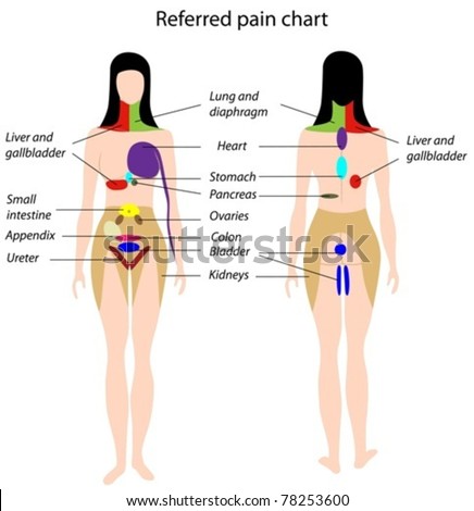 Referred pain chart