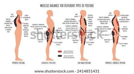 Comparison of muscle imbalance in various postural disorders. Kyphotic, lordotic, flat back posture infographics. The side view shows characteristic stretched and weakened, shortened and tens muscles