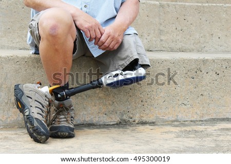 A person adjusting to a prosthetic limb