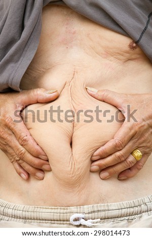 Closeup woman hands touch big belly, fat with cellulite abdomen