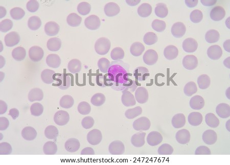 A lymphocyte is any of three subtypes of white blood cell in a vertebrate\'s immune system. All three are agranulocytes.