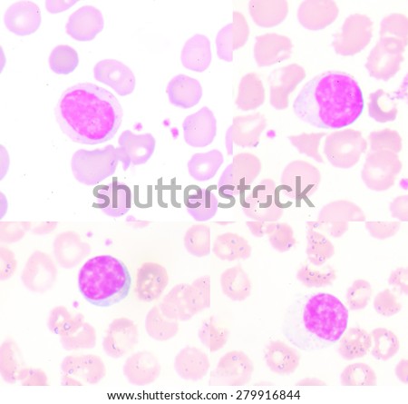 Lymphocytes are white blood cells or leucocytes in the human immune system.