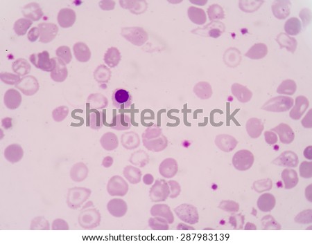 A nucleated red blood cell, or NRBC, is a red blood cell (RBC) that retains nucleus fine of microscope.