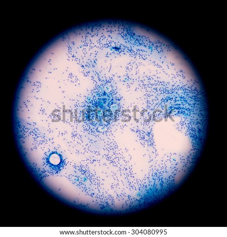 Slide sputum AFB.Negative find with microscope