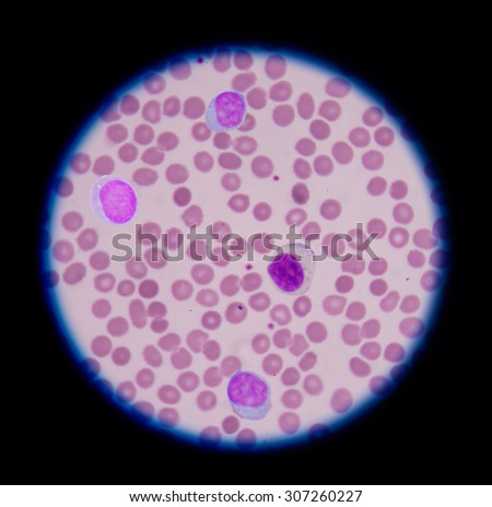 Mix shape Eosinophils. blood smear is often used as a follow-up test to abnormal results on a complete blood count (CBC) to evaluate the different types of blood cells.