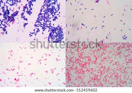 Gram staining, also called Gram\'s method, is a method of differentiating bacterial species into two large groups (Gram-positive and Gram-negative).