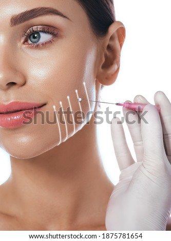 Thread facelift with arrows, concept of lifting skin, close up. Procedure facial contouring using mesothreads, isolated on white, high quality Stockfoto © 