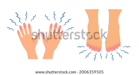 Numbness in hands and feet concept vector illustration on white background. Man or woman feeling pain in hand and feet. 商業照片 © 