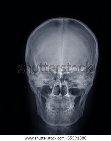 x-ray picture:human head,frontal view